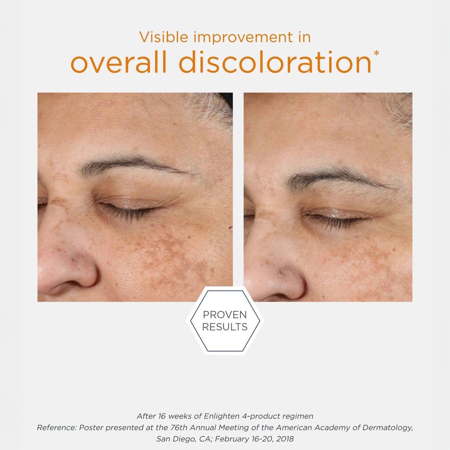 Enlighten Illuminating Serum 30ml