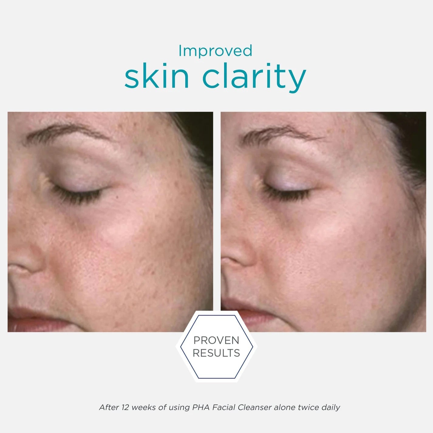 Restore PHA Facial Cleanser 200ml