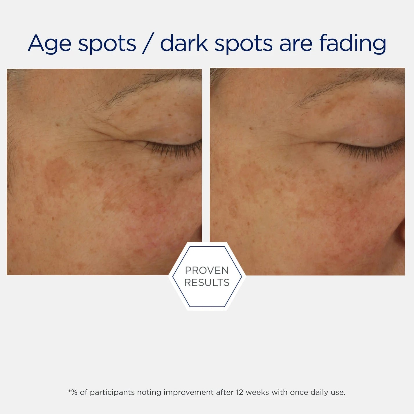 Skin Active FIRMING Potent Retinol Complex 30ml