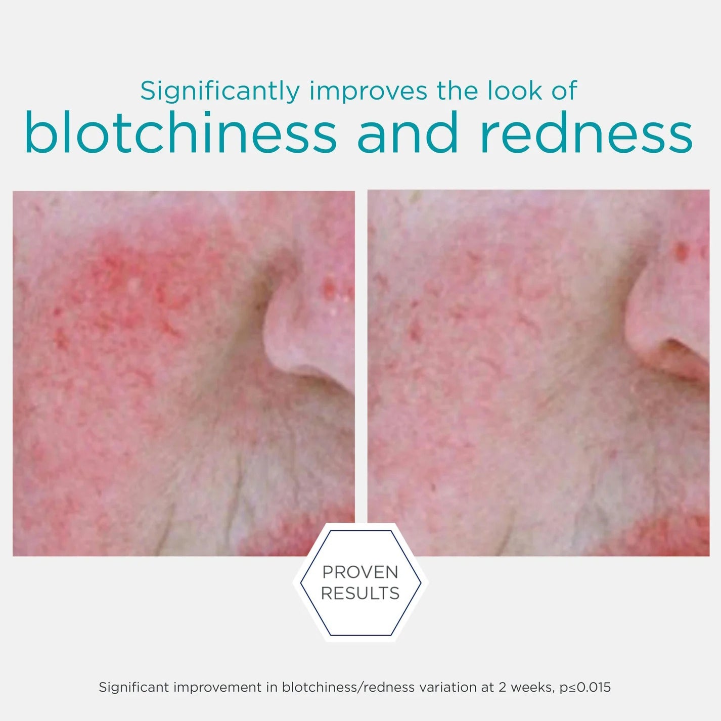 Restore Redness Neutralizing Serum 29g