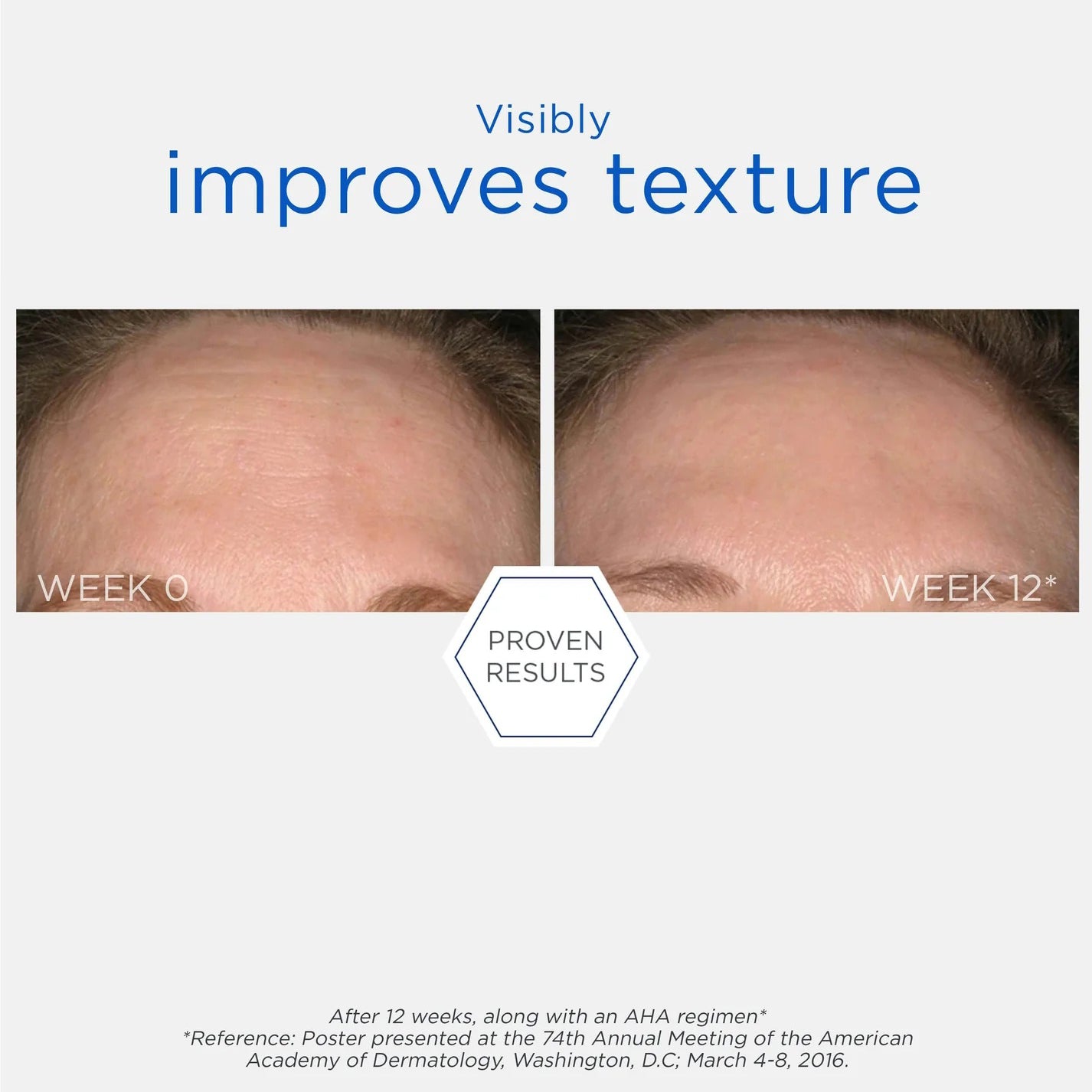 Resurface Smooth Surface Glycolic Peel 60ml / 36 Pads