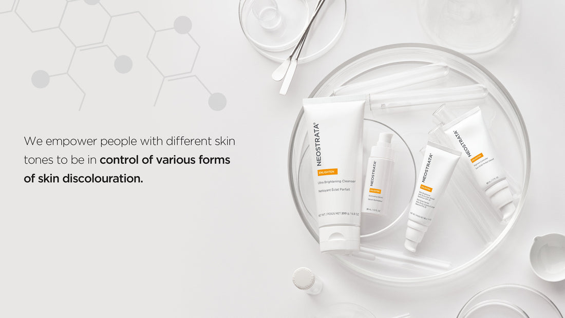 What Is Skin Discolouration & What Causes It?