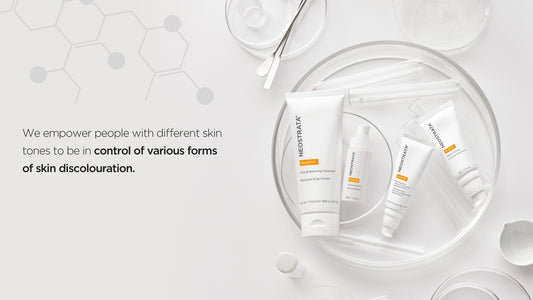 What Is Skin Discolouration & What Causes It?